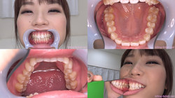 [Tooth fetish] I observed the teeth of Yano Tsubasa-chan!